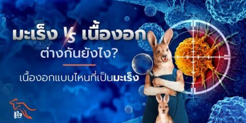 เนื้องอกกับมะเร็งต่างกันยังไง | ประกันมะเร็ง | รู้ใจ