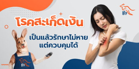 สะเก็ดเงินเกิดจากอะไร | ประกันมะเร็ง | รู้ใจ